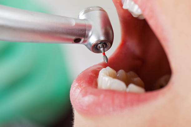 Best Broken or Cracked Tooth Emergency Dentist in Whitehouse, TX